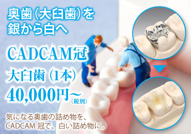 奥歯を銀から白へ。CADCAM冠のご案内。｜釧路市　よしもと歯科・矯正